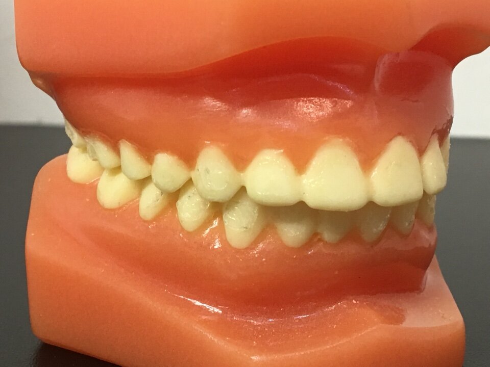 Bruxismo: una patología de actualidad.